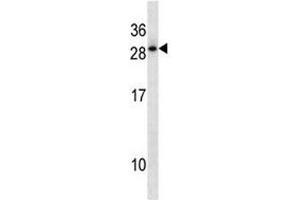 HOXD12 antibody western blot analysis in A549 lysate.