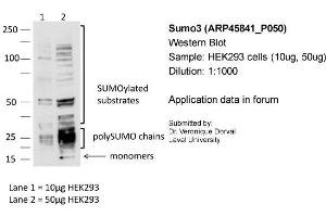 Sample: HEK293 cells (10ug, 50ug)Dilution: 1:1000