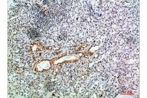 Immunohistochemical analysis of paraffin-embedded human-spleen, antibody was diluted at 1:200