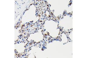 Immunohistochemistry of paraffin-embedded rat lung using SFTP Rabbit pAb (ABIN3017436, ABIN3017437, ABIN3017438 and ABIN6220091) at dilution of 1:50 (40x lens). (Surfactant Protein A1 anticorps)