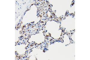 Immunohistochemistry of paraffin-embedded rat lung using SFTP Rabbit pAb (ABIN3017436, ABIN3017437, ABIN3017438 and ABIN6220091) at dilution of 1:50 (40x lens).