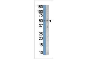 The anti-STK38L Pab (ABIN392120 and ABIN2841867) is used in Western blot to detect STK38L in Jurkat and T47D cell line lysates.
