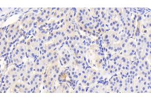 Detection of ACAT1 in Human Kidney Tissue using Polyclonal Antibody to Acetyl Coenzyme A Acetyltransferase 1 (ACAT1)