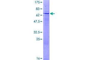 Image no. 1 for Zinc Finger Protein 547 (ZNF547) (AA 1-402) protein (GST tag) (ABIN1326273)