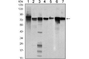 Western blot analysis using STAT5B mouse mAb against Hela (1), K562 (2), NIH/3T3 (3), C6 (4), HEK293 (5), Jurkat (6) and HL-60 (7) cell lysate. (STAT5B anticorps)