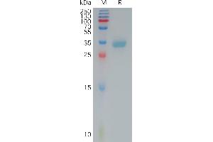 Human C(145-157) Protein, mFc Tag on SDS-PAGE under reducing condition.