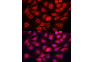 Immunofluorescence analysis of C6 cells using C Rabbit pAb (ABIN7266110) at dilution of 1:50 (40x lens).