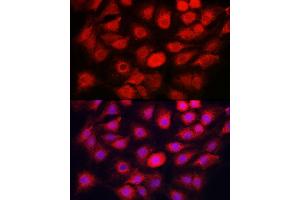 Immunofluorescence analysis of C6 cells using C Rabbit pAb (ABIN7266110) at dilution of 1:50 (40x lens). (Caspase 1 anticorps)
