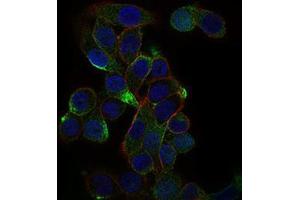 Immunofluorescence analysis of MCF-7 cells using CD59 mouse mAb (green). (CD59 anticorps  (AA 31-111))