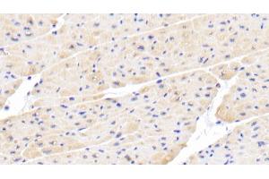 Detection of IL18 in Porcine Cardiac Muscle Tissue using Polyclonal Antibody to Interleukin 18 (IL18)