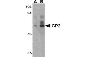 Western Blotting (WB) image for anti-DEXH (Asp-Glu-X-His) Box Polypeptide 58 (DHX58) (C-Term) antibody (ABIN1030481) (DHX58 anticorps  (C-Term))