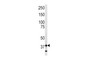 Western blot analysis of Annexin V antibody (C-term) (ABIN390502 and ABIN2840858) in SK-Br-3 cell line lysates (35 μg/lane). (Annexin V anticorps  (C-Term))