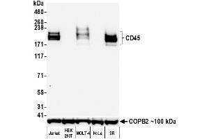Western Blotting (WB) image for anti-Protein tyrosine Phosphatase, Receptor Type, C (PTPRC) (C-Term) antibody (ABIN7454030)