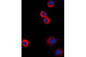 Immunofluorescent analysis of IGF1 Receptor (pY1161) staining in HeLa cells.