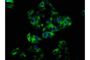 Immunofluorescence staining of HepG2 cells with ABIN7161004 at 1:33, counter-stained with DAPI. (NOX1 anticorps  (AA 418-564))