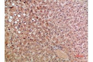 Immunohistochemical analysis of paraffin-embedded human-liver, antibody was diluted at 1:200