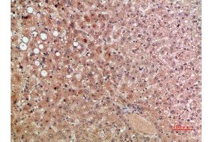 Immunohistochemical analysis of paraffin-embedded human-liver, antibody was diluted at 1:200 (CCR5 anticorps  (AA 151-200))