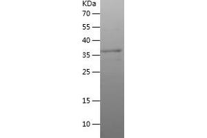 Western Blotting (WB) image for Brain Expressed X-Linked 2 (BEX2) (AA 1-128) protein (His-IF2DI Tag) (ABIN7122018)