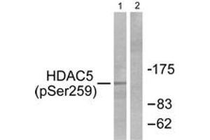 Western blot analysis of extracts from HepG2 cells, using HDAC5 (Phospho-Ser259) Antibody.