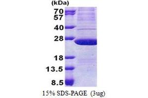 SDS-PAGE (SDS) image for ATP Synthase, H+ Transporting, Mitochondrial Fo Complex, Subunit D (ATP5H) (AA 1-161) protein (His tag) (ABIN7529247)