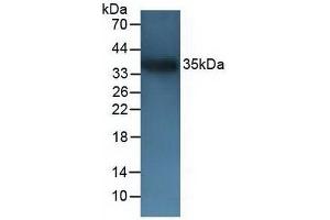Western blot analysis of Mouse Testis Tissue. (CD72 anticorps  (AA 143-345))