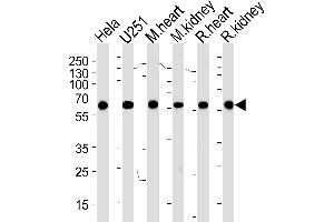 Western blot analysis of lysates from Hela,  cell line, mouse heart and kidney, rat heart and kidney tissue (from left to right), using PHB Antibody (ABIN1882046 and ABIN2838486). (BBS4 anticorps  (AA 1-240))
