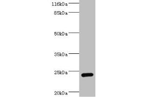Western blot All lanes: STXBP6 antibody at 2 μg/mL + Mouse brain tissue Secondary Goat polyclonal to rabbit at 1/10000 dilution Predicted band size: 24, 12 kDa Observed band size: 24 kDa (STXBP6 anticorps  (AA 2-210))