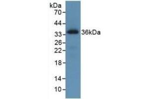 Detection of Recombinant ROS1, Human using Monoclonal Antibody to C-Ros Oncogene 1, Receptor Tyrosine Kinase (ROS1)
