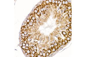 Immunohistochemistry of paraffin-embedded rat ovary using MT-ND4 Rabbit pAb (ABIN7268602) at dilution of 1:250 (40x lens).
