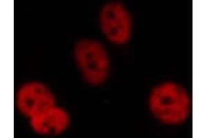 ABIN6277660 staining HepG2 by IF/ICC.