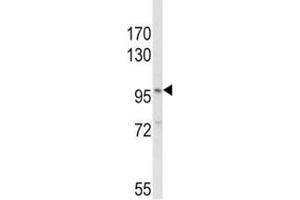 Western blot analysis of NLRP3 antibody and MDA-MB231 lysate