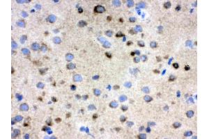 IHC analysis of TCP1 delta using anti-TCP1 delta antibody .