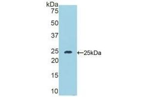 Detection of Recombinant DSC1, Mouse using Polyclonal Antibody to Desmocollin 1 (DSC1) (Desmocollin 1 anticorps  (AA 135-340))