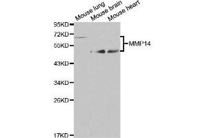 Western blot analysis of extracts of various cell lines, using MMP14 antibody. (MMP14 anticorps)