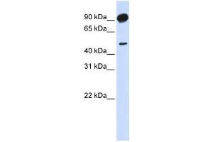 Adducin beta 2 antibody used at 1 ug/ml to detect target protein. (Adducin beta 2 anticorps)