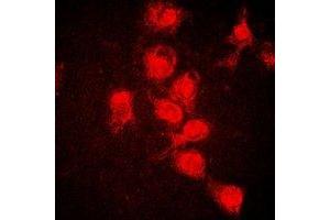Immunofluorescent analysis of STAT1 (pY701) staining in HeLa cells. (STAT1 anticorps  (C-Term, pTyr701))
