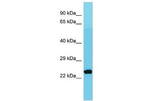 Host: Rabbit Target Name: MRPS26 Sample Type: Jurkat Whole Cell lysates Antibody Dilution: 1. (MRPS26 anticorps  (C-Term))