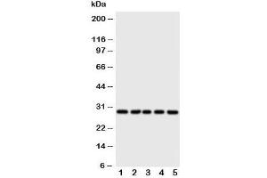 Western blot testing of 14-3-3 sigma antibody and Lane 1:  HeLa;  2: A549;  3: A549;  4: COLO320;  5: SE620 cell lysate (14-3-3 sigma/SFN anticorps  (AA 140-156))