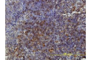 Immunoperoxidase of monoclonal antibody to GSDMDC1 on formalin-fixed paraffin-embedded human tonsil tissue. (GSDMD anticorps  (AA 1-484))