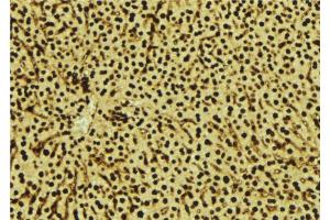 ABIN6277543 at 1/100 staining Mouse liver tissue by IHC-P.