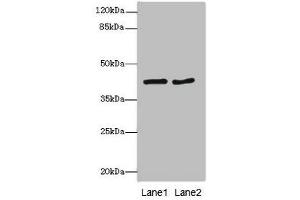 MTCH1 anticorps  (AA 100-250)