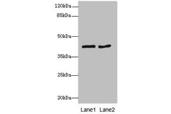 MTCH1 anticorps  (AA 100-250)