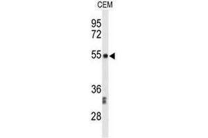 Western blot analysis of CENPI Antibody (Center) in CEM cell line lysates (35µg/lane).