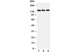 Western blot testing of Myosin Phosphatase antibody and Lane 1:  rat liver;  2: human 293T;  3: (h) HeLa cell lysate. (Myosin Binding Subunit anticorps  (N-Term))
