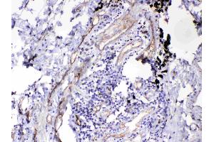 IHC analysis of HOMER3 using anti-HOMER3 antibody .
