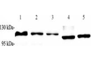 Western blot analysis of ZSCAN20 (ABIN7076252) at dilution of 1: 1000,Lane 1: Raji cell lysate,Lane 2: K562 cell lysate,Lane 3: HEK293 cell lysate,Lane 4: Mouse heart tissue lysate,Lane 5: Rat heart tissue lysate (ZSCAN20 anticorps)