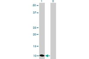 Western Blot analysis of S100A6 expression in transfected 293T cell line by S100A6 monoclonal antibody (M16), clone 6D1. (S100A6 anticorps  (AA 18-90))