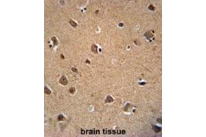 Immunohistochemistry (IHC) image for anti-V-Akt Murine Thymoma Viral Oncogene Homolog 3 (Protein Kinase B, Gamma) (AKT3) antibody (ABIN2995321)