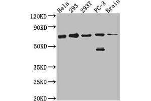 Western Blot Positive WB detected in: Hela whole cell lysate, 293 whole cell lysate, 293T whole cell lysate, PC-3 whole cell lysate, Mouse Brain whole cell lysate All lanes: LTA4H antibody at 1:1000 Secondary Goat polyclonal to rabbit IgG at 1/50000 dilution Predicted band size: 70, 60, 58, 67 kDa Observed band size: 70 kDa (Recombinant LTA4H anticorps)