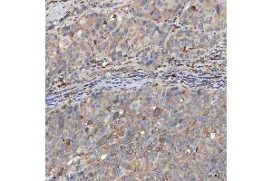 IHC analysis of EIF2AK1 using anti-EIF2AK1 antibody (ABIN7601508). (EIF2AK1 anticorps  (AA 37-508))